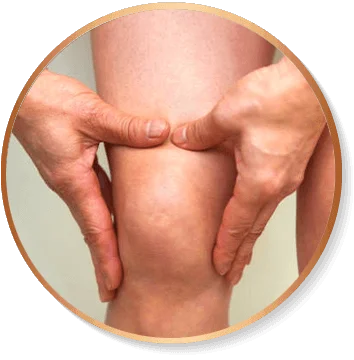 Ilustração de Inchaço nas Juntas